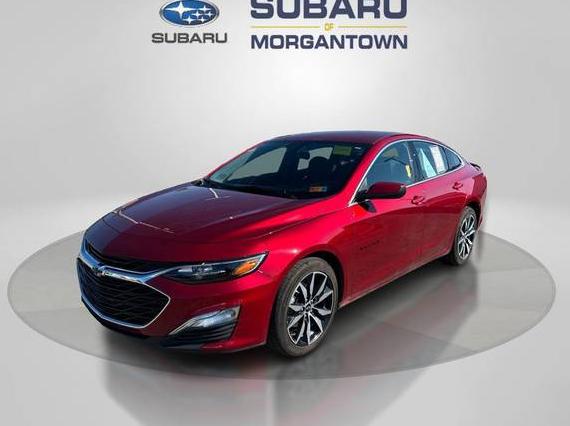 CHEVROLET MALIBU 2025 1G1ZG5ST0SF102155 image CHEVROLET MALIBU 2025 1G1ZG5ST0SF102155 image