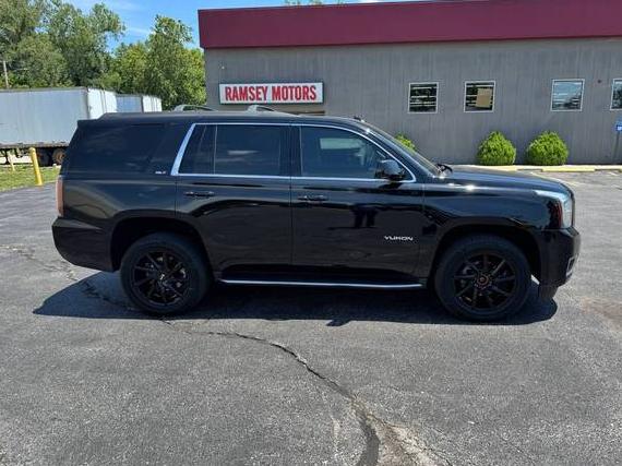 GMC YUKON 2017 1GKS2BKC6HR149790 image